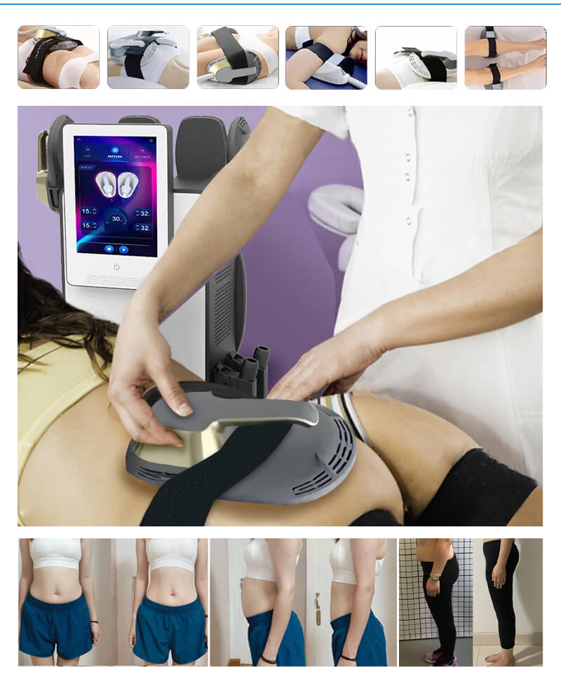 Slimming machine HL-EM12(image 5)