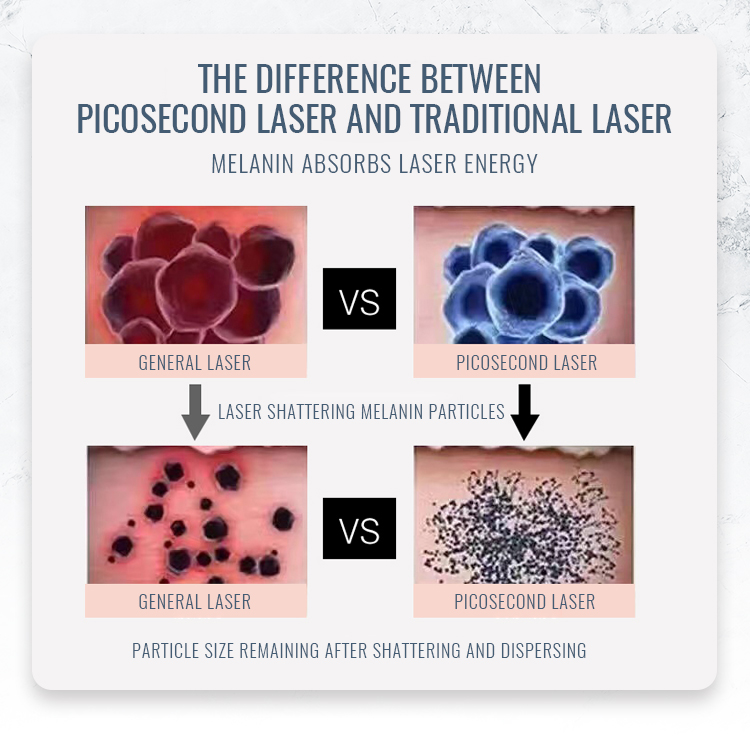 Laser Tattoo Removal System HL-C13(image 1)