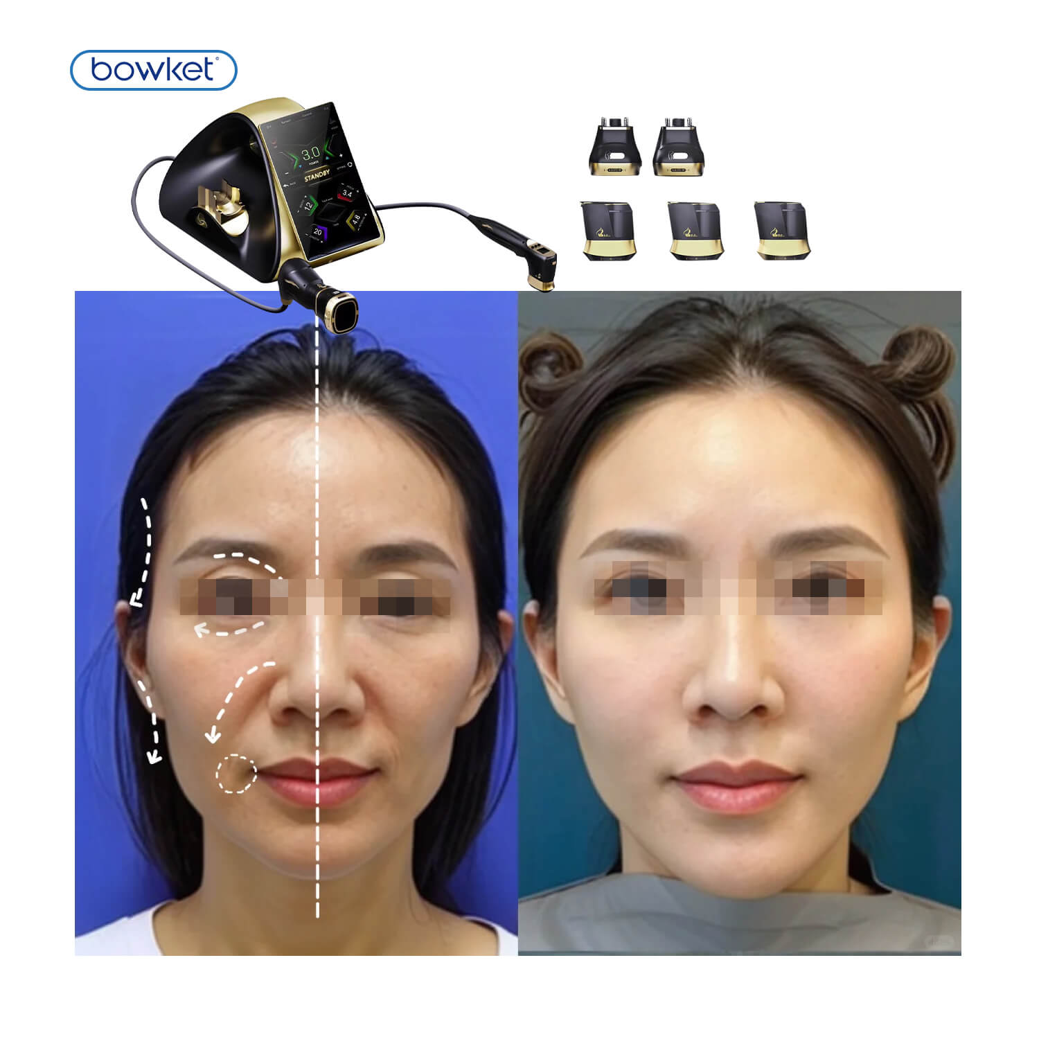 Bowket skin tightening face lifting body slimming  home use beauty equipment body(image 9)