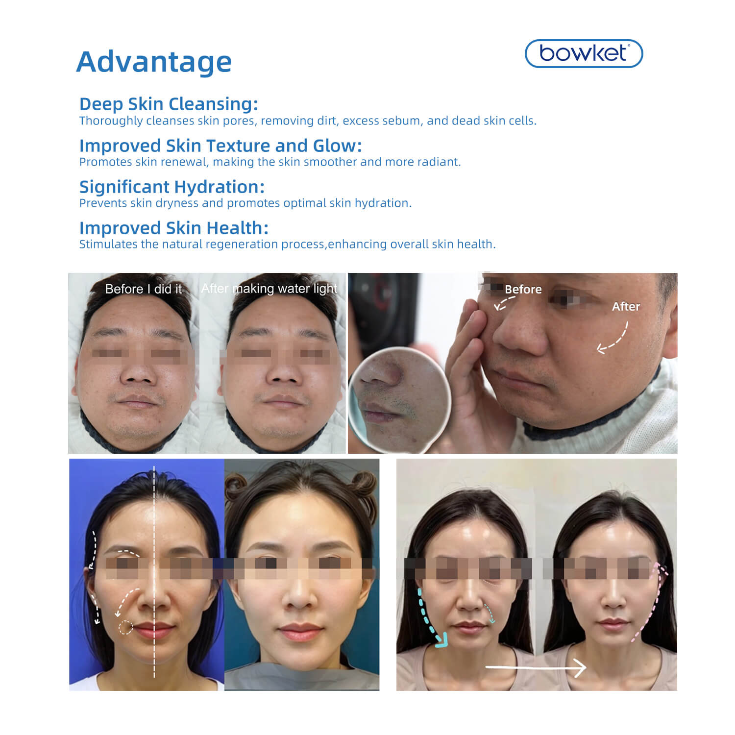 Bowket 8in1 hydro face cleaing hydra-dermabrasion-machine(image 9)