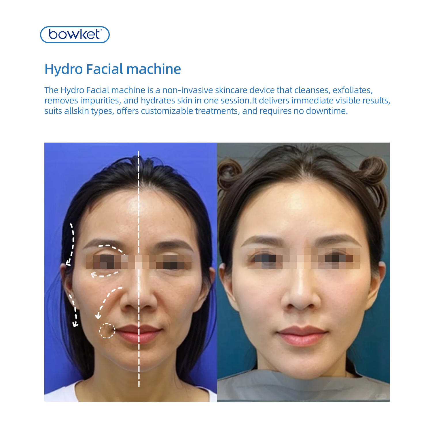3in1 Hydro Facial Machine(image 2)