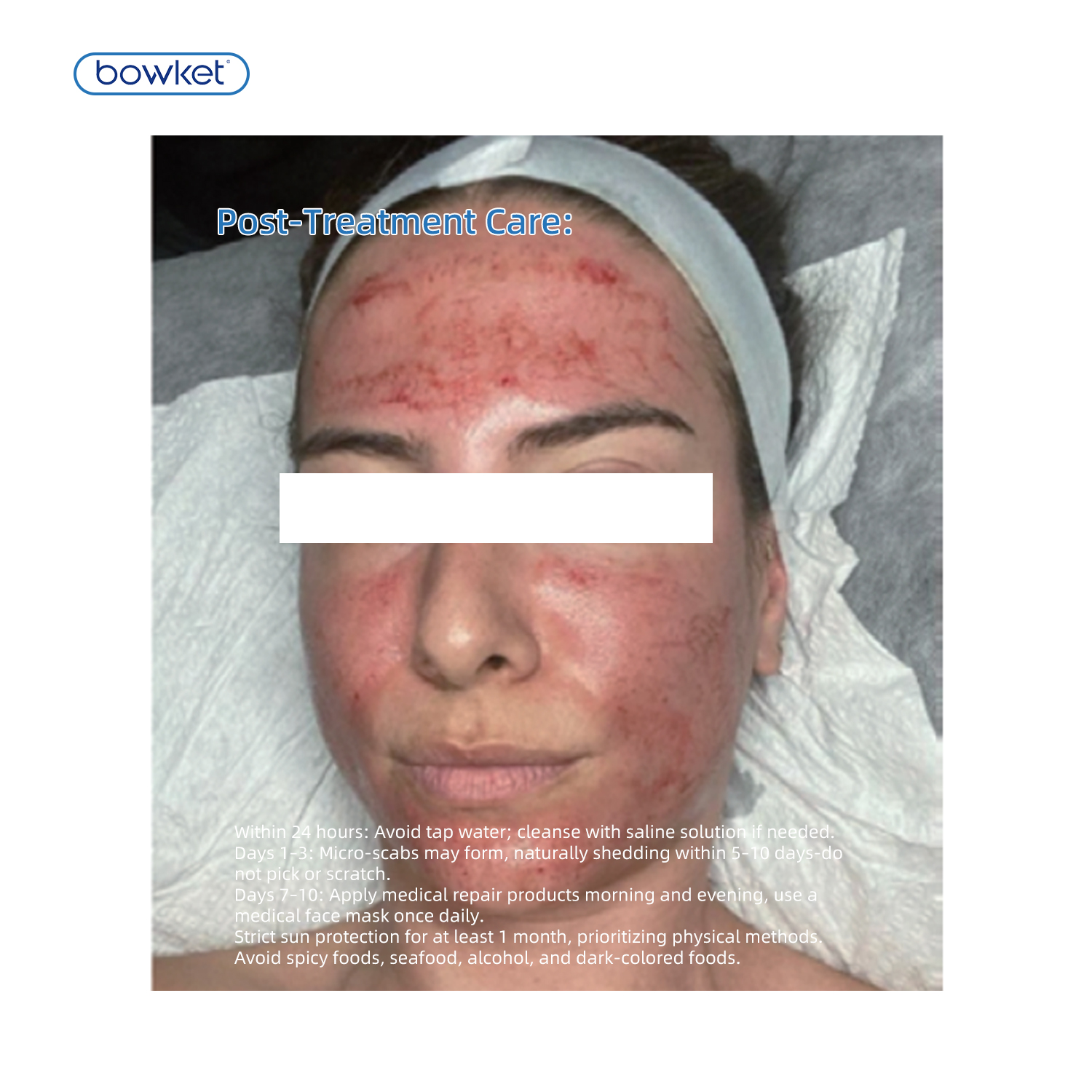 3rd-Generation CryoM9 (Ice Gold RF Microcrystal)(image 8)